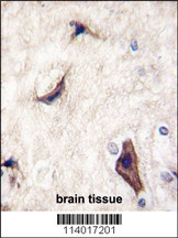 RASGRF1 Antibody