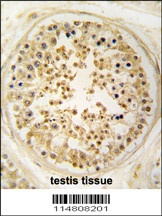 EARS2 Antibody