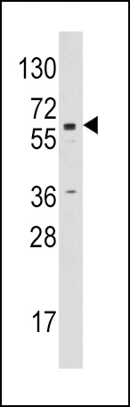 CYP19A1 Antibody