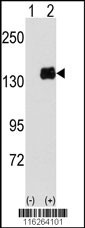 PUM1 Antibody