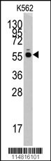 HARS Antibody
