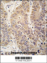 HARS Antibody