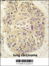 FARSA Antibody