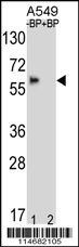 BBS4 Antibody