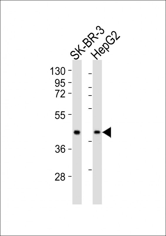 ACAT1 Antibody
