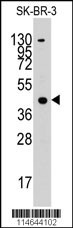 ACAT1 Antibody