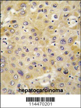 PBP Antibody