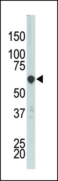 CDK18 Antibody