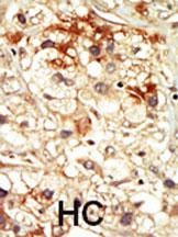 CDK17 Antibody