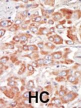 STK23 Antibody