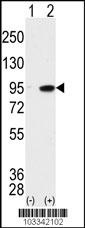 MAK Antibody