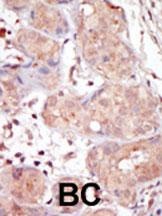 MAK Antibody