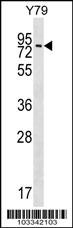MAK Antibody