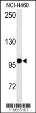 HIPK2 Antibody