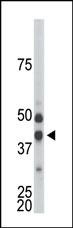 CDKL1 Antibody