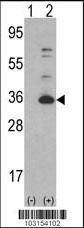 CDK4 Antibody