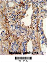 CDK4 Antibody