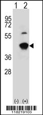 GCAT Antibody