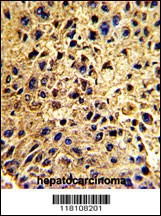 NUP62 Antibody