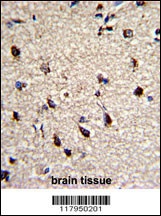 DPT Antibody