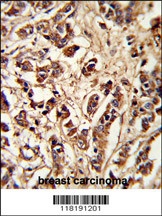 PCM-1 Antibody