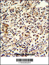 PCM-1 Antibody