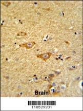 OMD Antibody