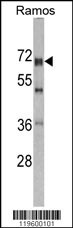 DDX5 Antibody