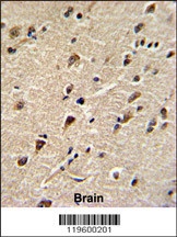 DDX5 Antibody