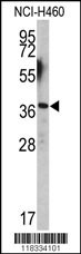 EN2 Antibody