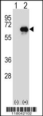 CETP Antibody