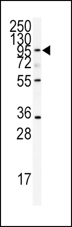 ADAMTS13 Antibody