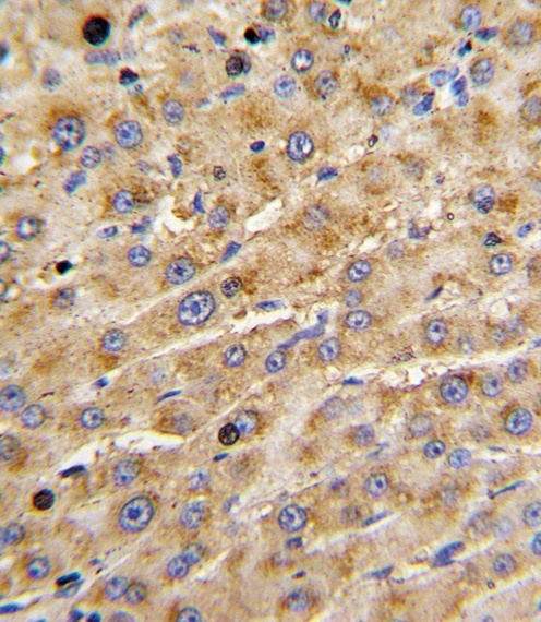 ADAMTS13 Antibody