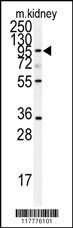 ADAM9 Antibody