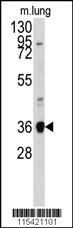 ANXA2 Antibody