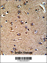 GGTLA1 Antibody