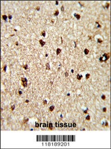 TECPR1 Antibody