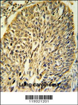 FKBP9 Antibody