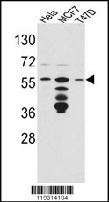 FKBP4 Antibody