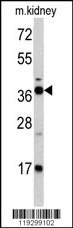 FBP1 Antibody