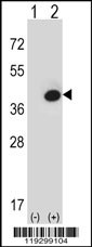 FBP1 Antibody