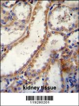 FKBP10 Antibody