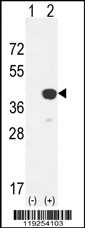 CTSK Antibody