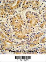 MOBKL1B Antibody