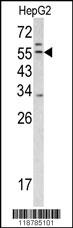 TMPRSS2 Antibody