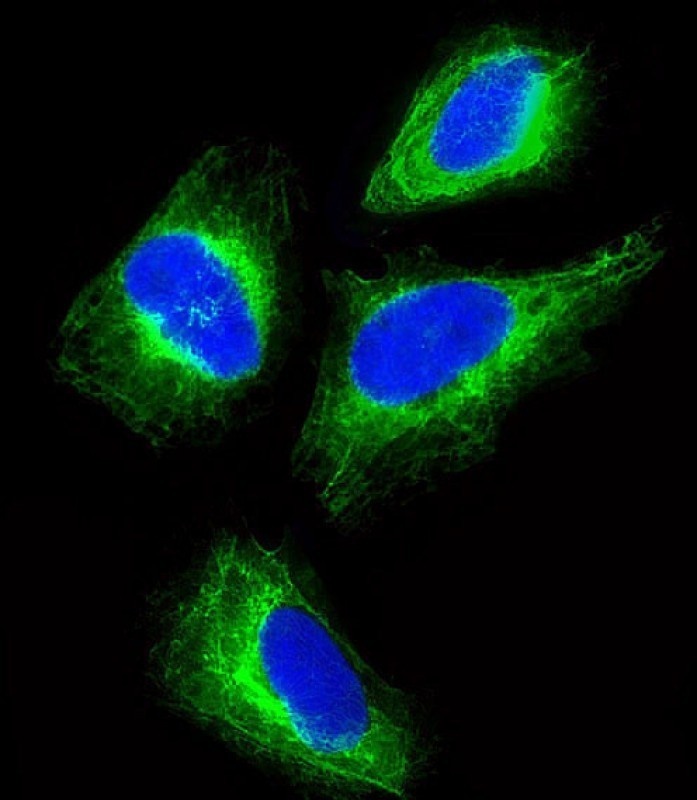 KRT18 Antibody