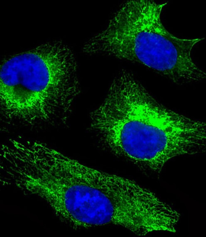 KRT18 Antibody