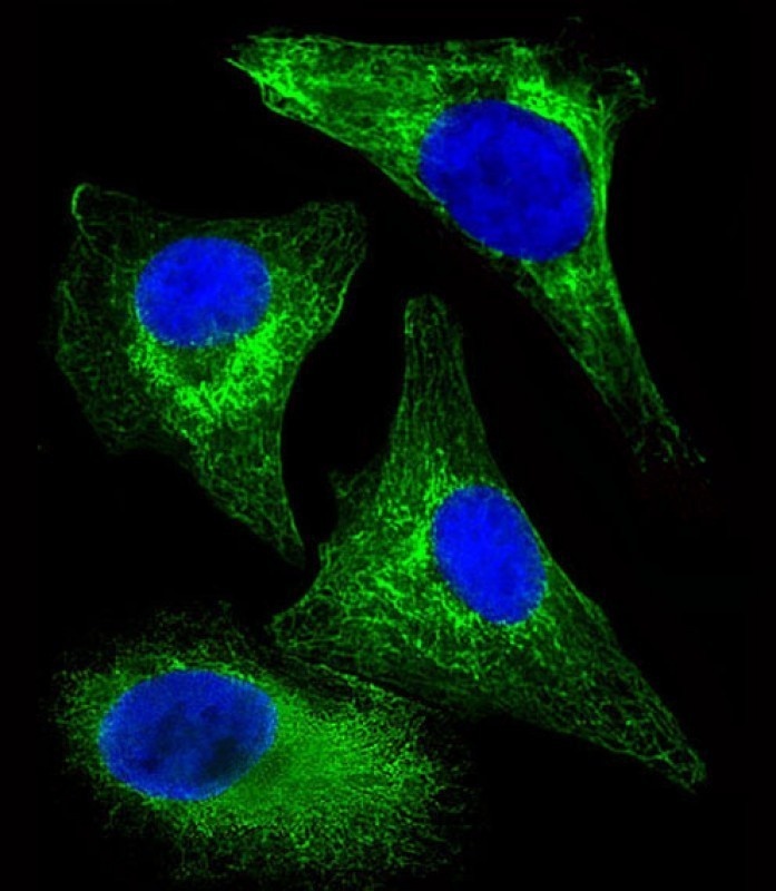 KRT18 Antibody