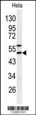 SERPINH1 Antibody