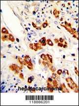 CEACAM1 Antibody